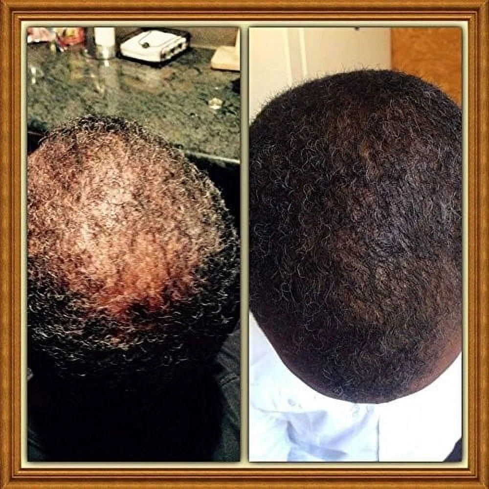 32 Ounce Hair Skin and Nail Vitamin Formula G357
